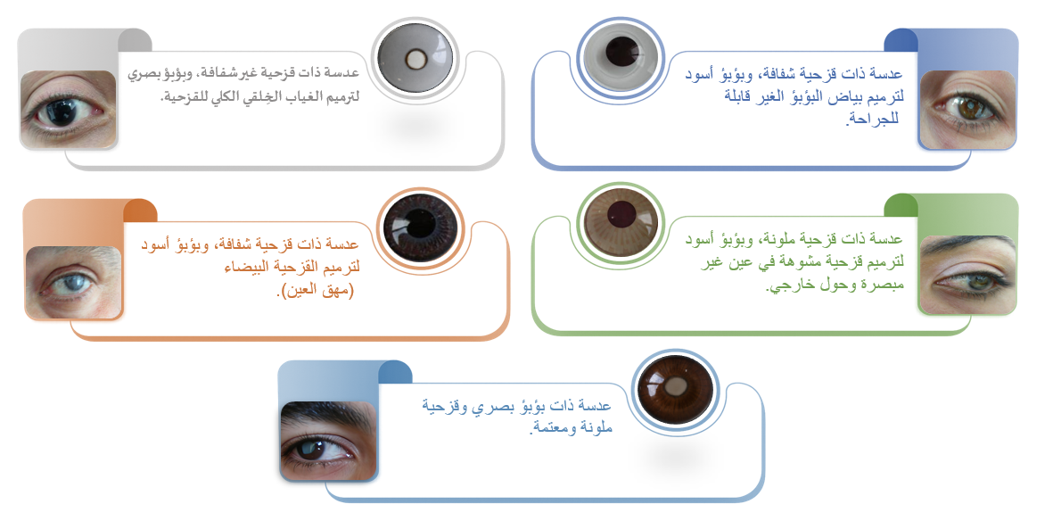 أشكال العدسات الترميمية