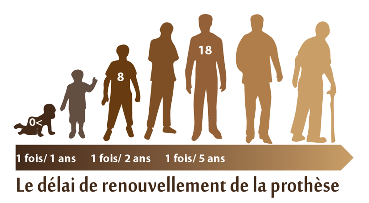 Le délai de renouvellement de la prothèse