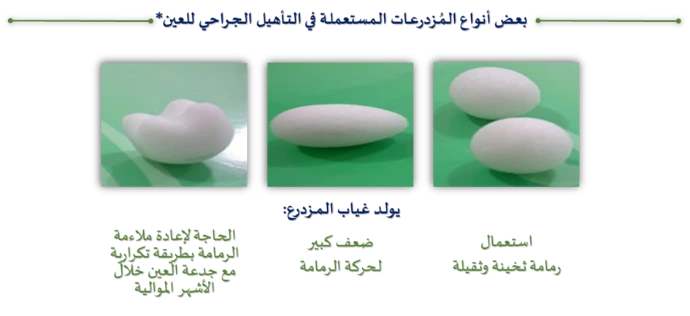 المزدرعات