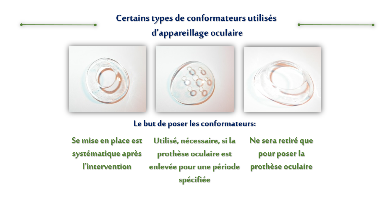 Certains types de conformateurs utilisés d'appareillage oculaire